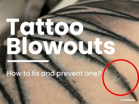 Fixing a Blowout Tattoo