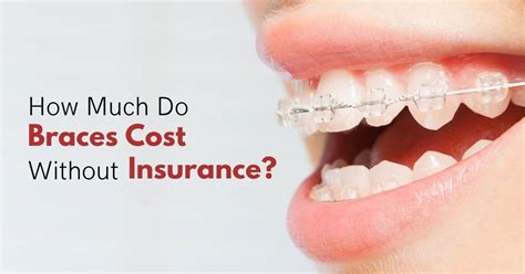 Cost of Military Insurance for Braces