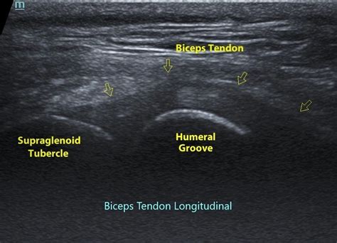 Musculoskeletal Sonography Images