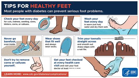 Navy sandals and foot health