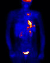 Nuclear Medicine