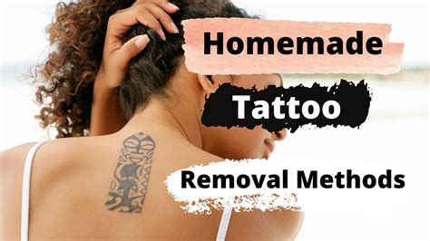 Other Tattoo Removal Methods