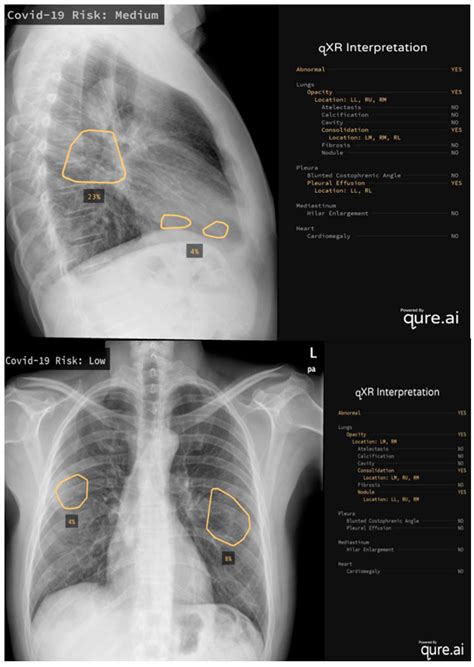 Radiography