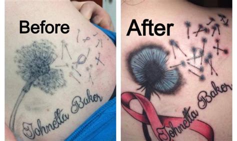 Tattoo Removal and Cover-Ups