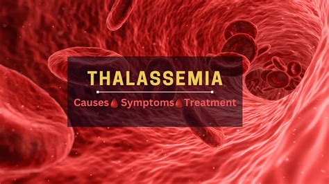 Thalasemia