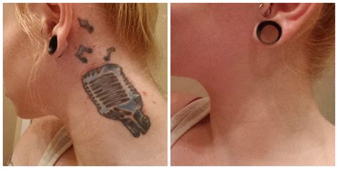 Waterproof Tattoo Cover Makeup Before And After