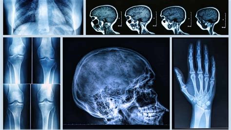 X-Ray Imaging Modalities