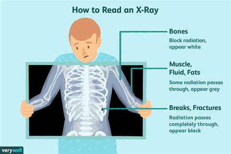 X-Ray Imaging Techniques