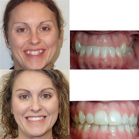 affordable orthodontic treatments