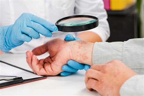 An allergist diagnosing eczema