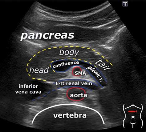 Anatomical Knowledge in Sonography