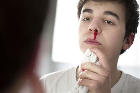 A person with a bloody nose, symbolizing spiritual growth