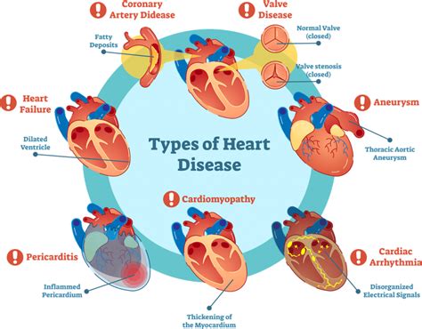 Cardiac Conditions