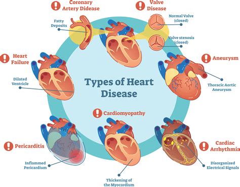 Cardiac Conditions