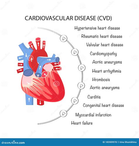 Cardiovascular Conditions