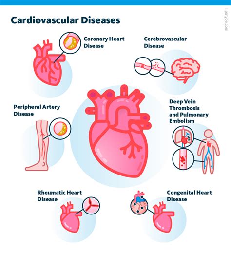 Cardiovascular disease