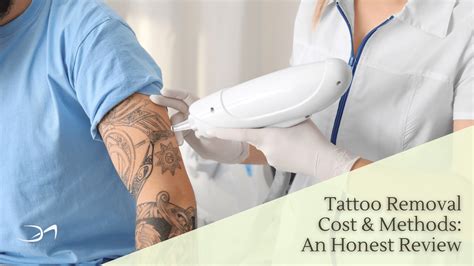 Choosing the right tattoo removal method