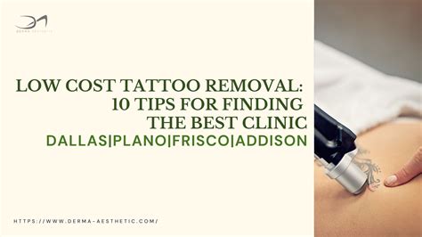 Cost of Tattoo Removal