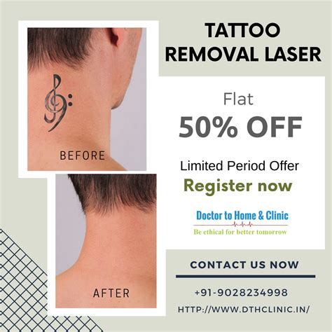 Dallas tattoo removal clinics