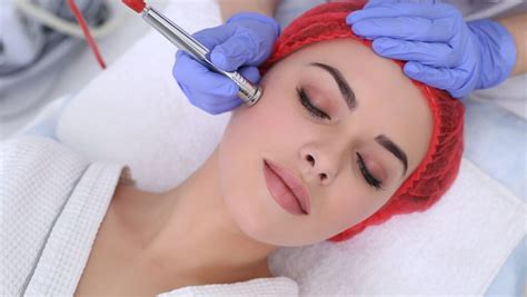 Dermabrasion method