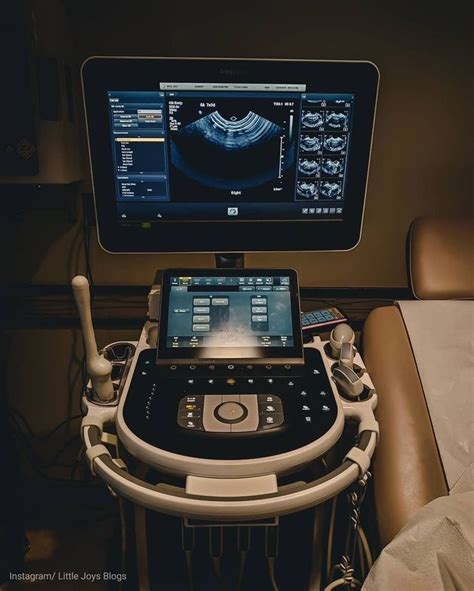 Diagnostic Medical Sonography