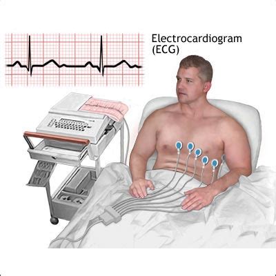 Electrocardiogram Test