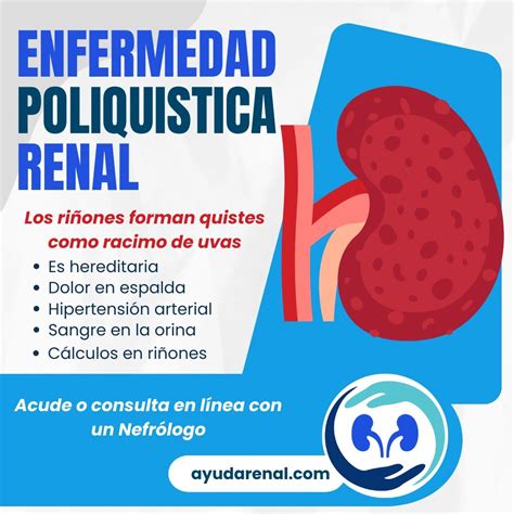 Enfermedad renal poliquística