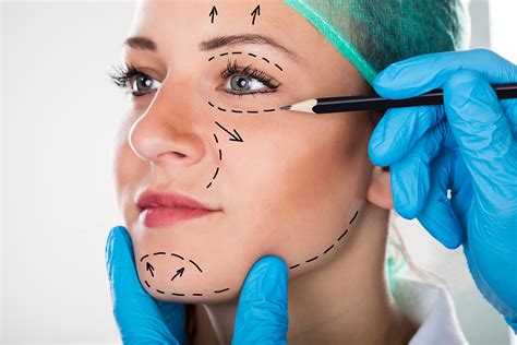 Facial plastic surgery procedure