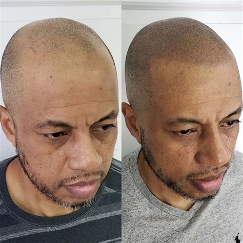 Hairline tattoos for men and women