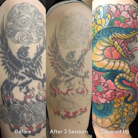 How tattoo sticker cover ups work