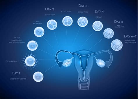 IVF embryo transfer