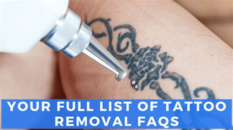 Frequently asked questions about laser tattoo removal