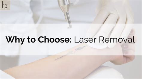 Laser tattoo removal method