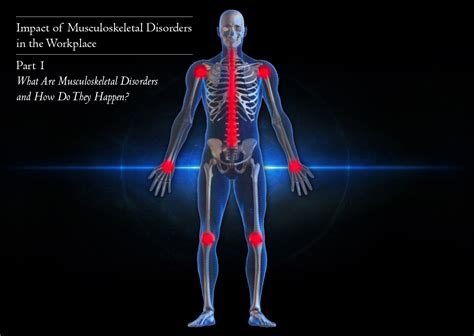 Musculoskeletal Conditions