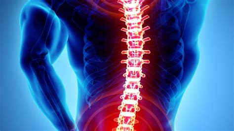 Musculoskeletal Conditions