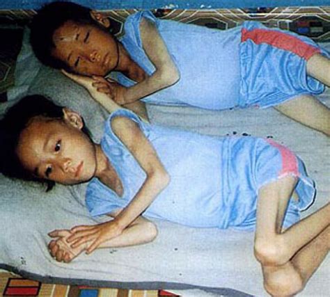 North Korea Famine