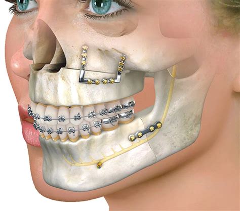 Oral Maxillofacial Surgeon with Patient