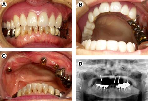 Oral Maxillofacial Surgery Figures Gallery 1