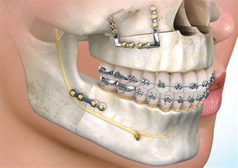 Oral Maxillofacial Surgery Figures Gallery 2