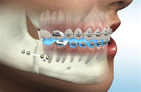 Oral Maxillofacial Surgery Figures Gallery 8