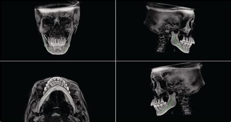 Oral Maxillofacial Surgery Figures