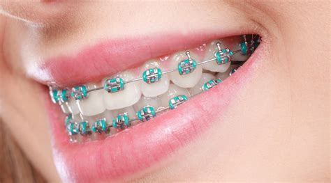 orthodontic treatment cost