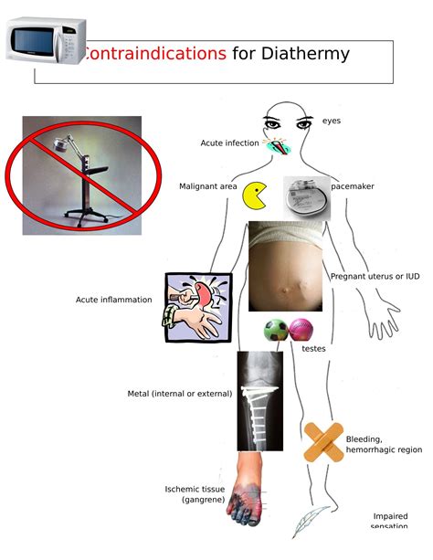 Physical Therapy Modalities