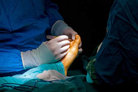 Podiatrist performing surgery