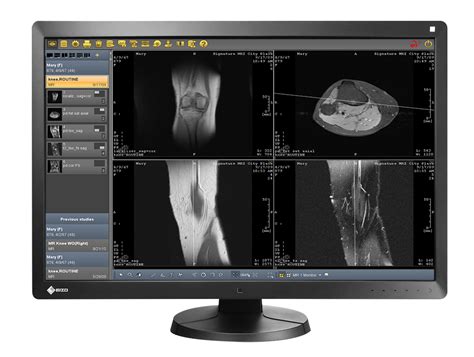 Radiology software