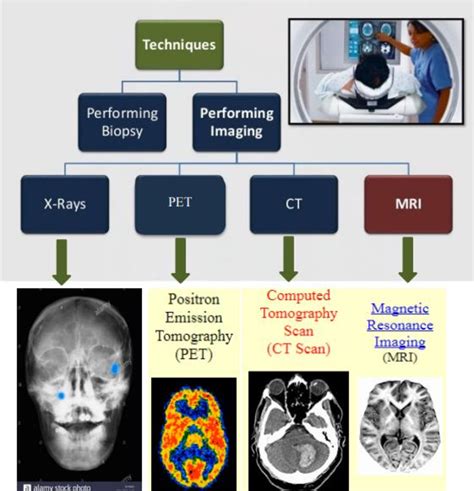 Radiology techniques