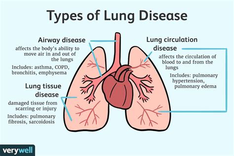 Respiratory Conditions