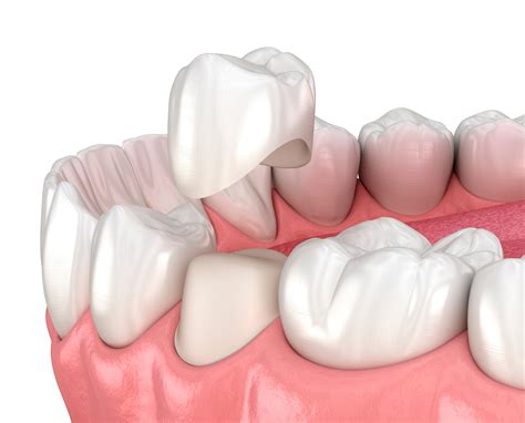 Restorative Dentistry