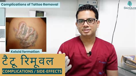 Risks and complications of tattoo removal