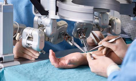 Robotic Arm Operation